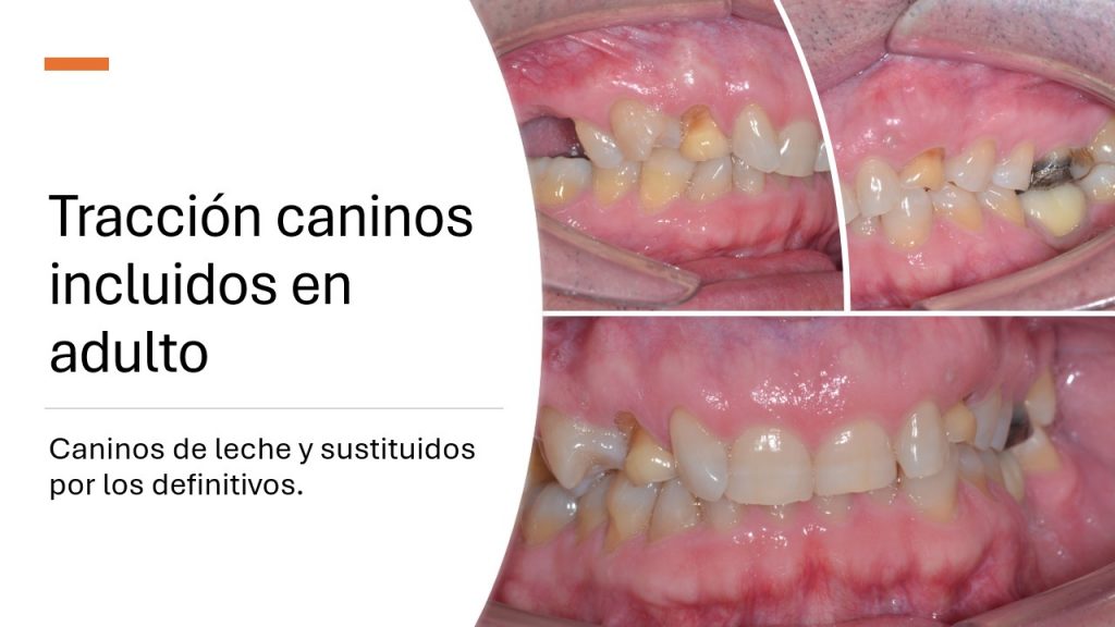 slide13