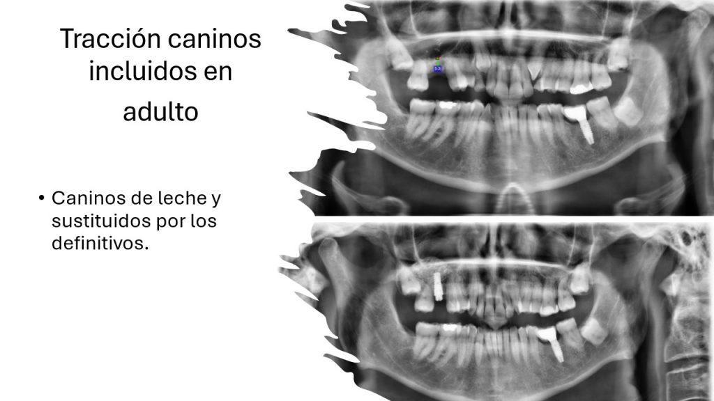 slide15