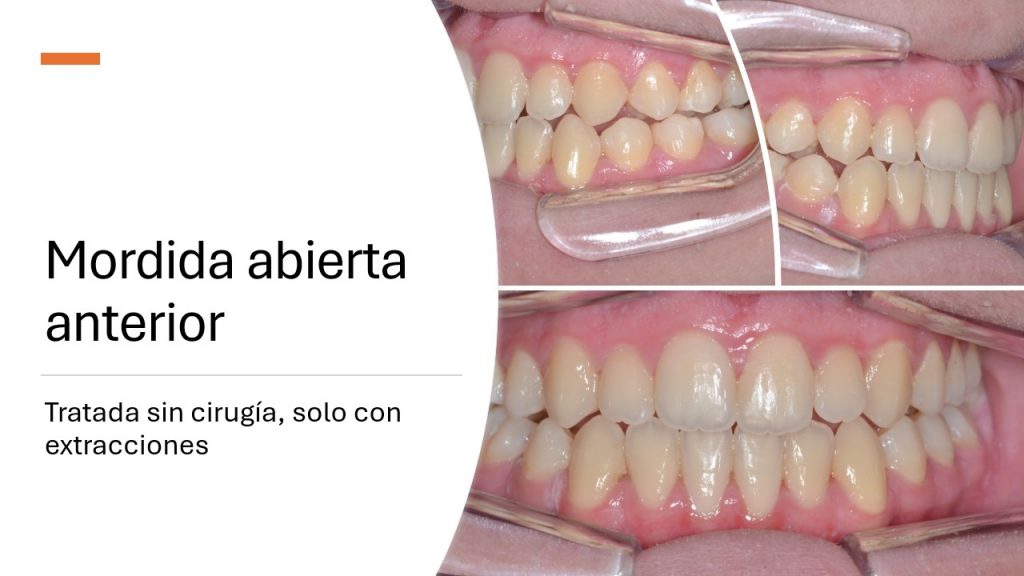 slide2