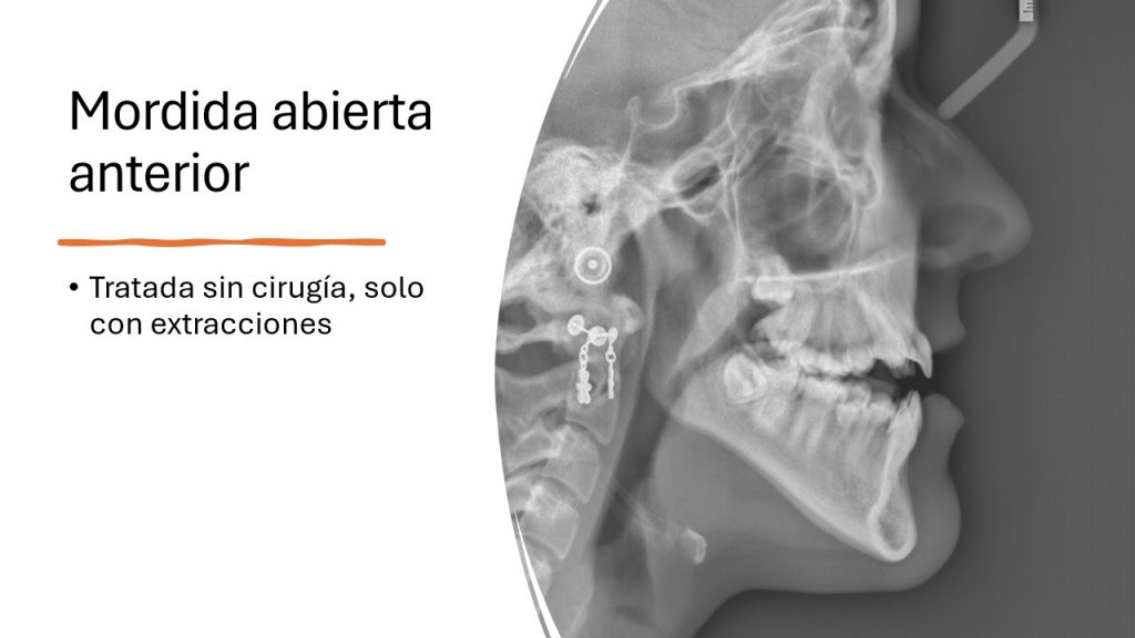 slide3