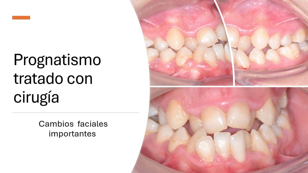 slide5