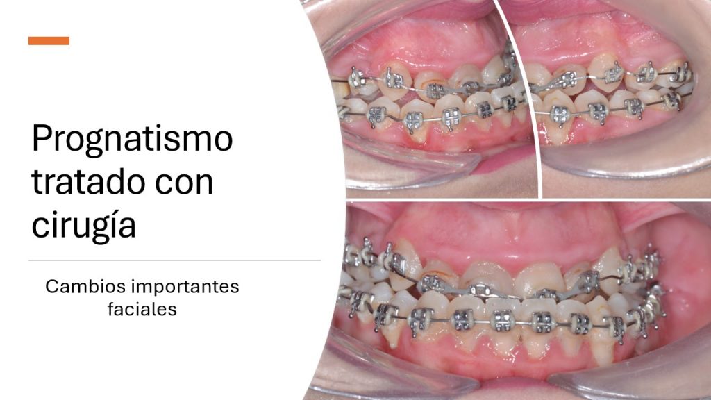 slide6