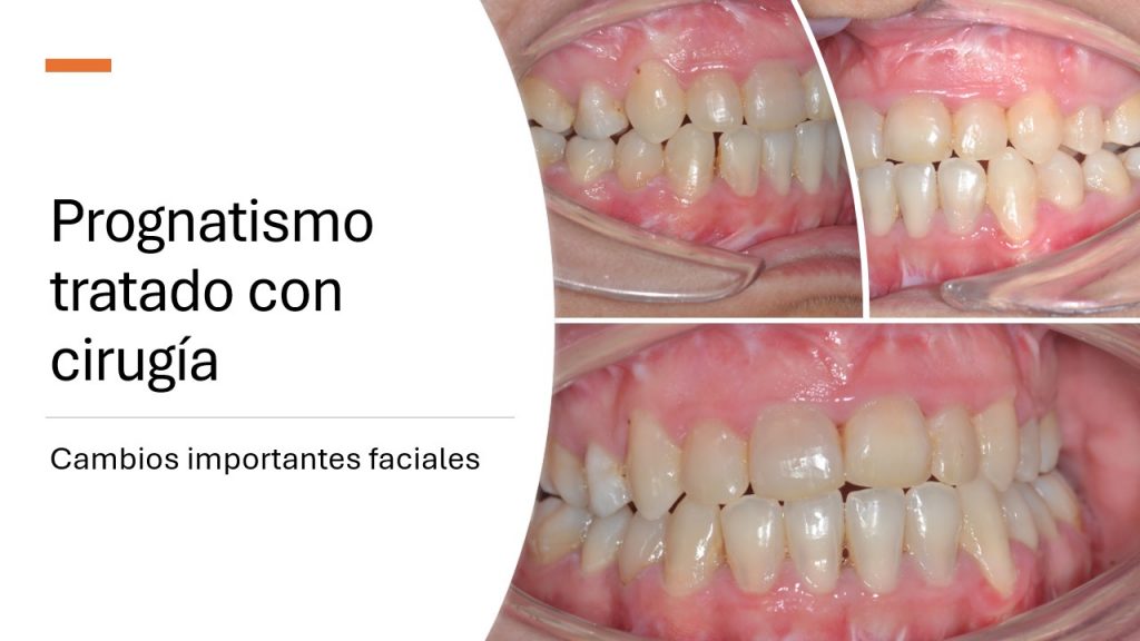 slide7