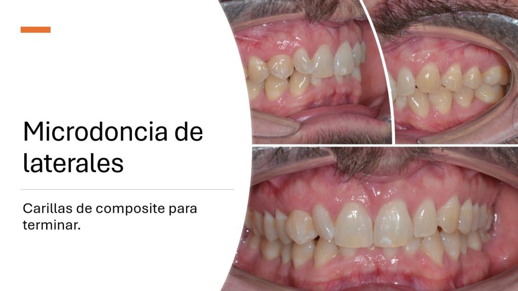 slide8