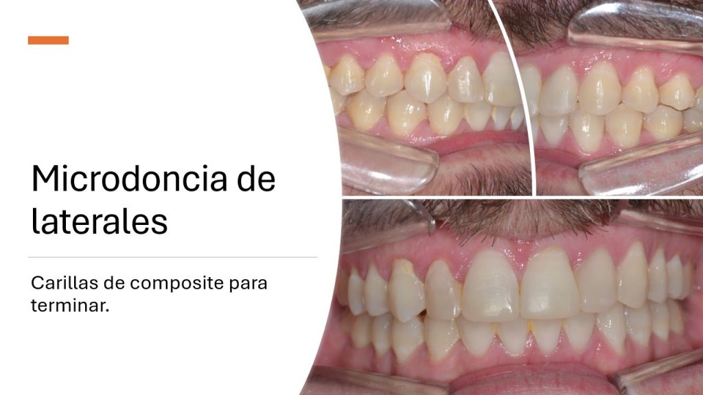 slide9