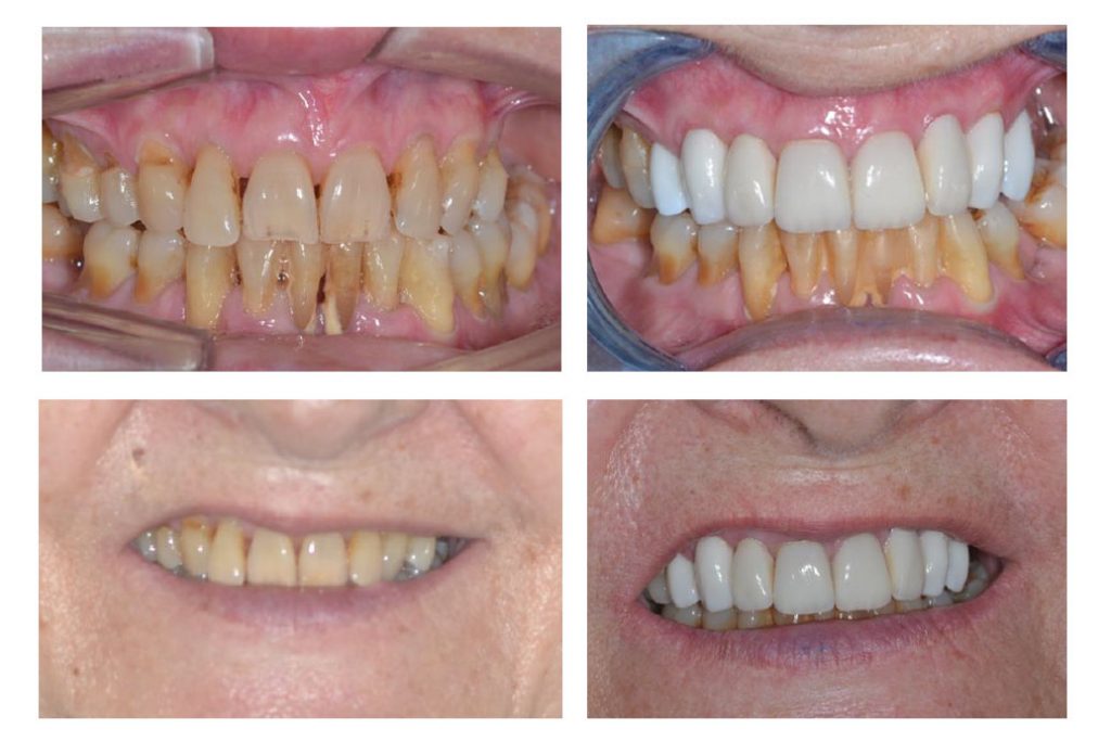tratamiento estética dental1