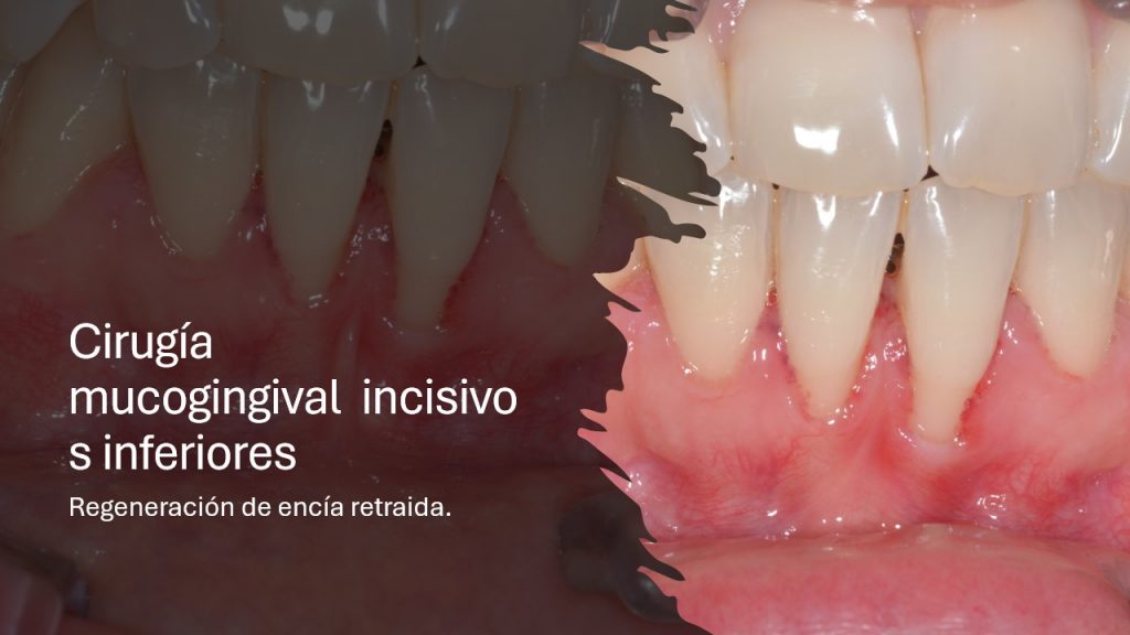 slide10