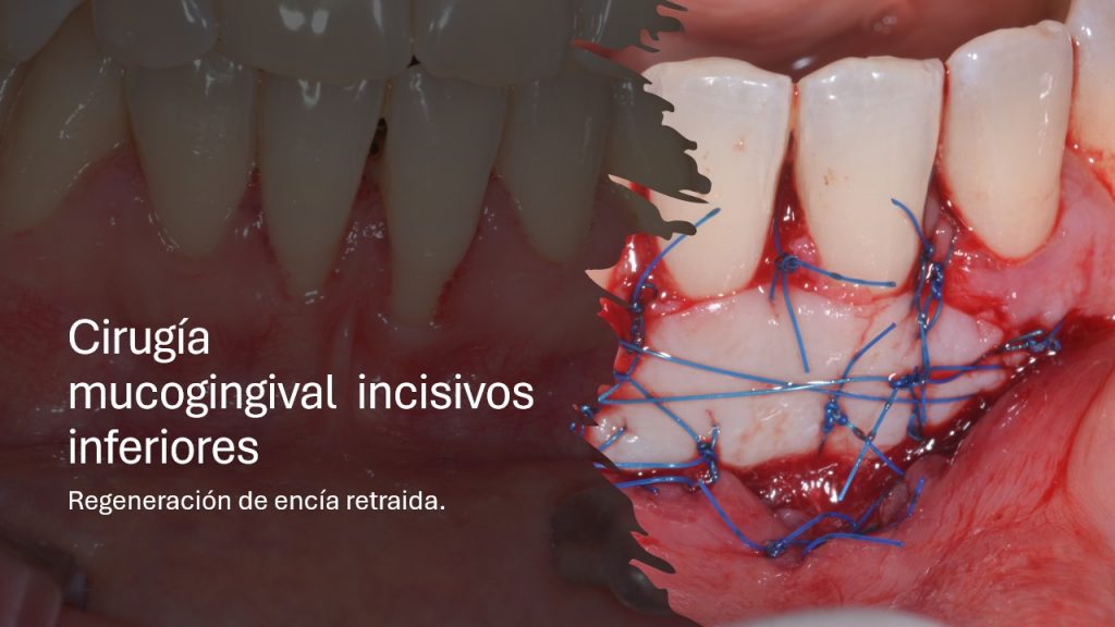 slide11