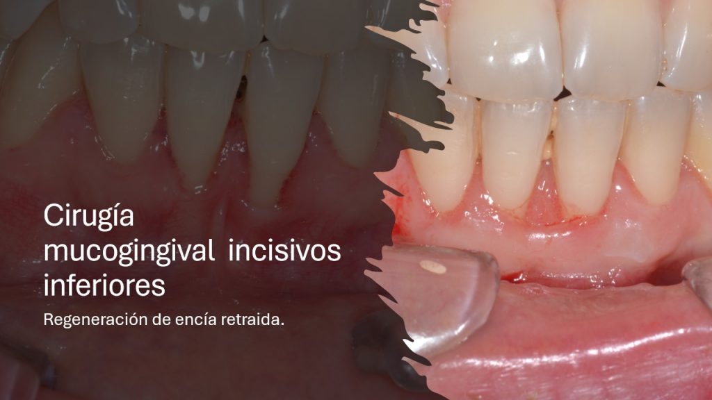slide12